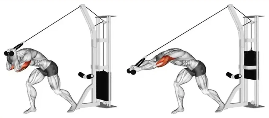 Cable high-pulley overhead triceps extension